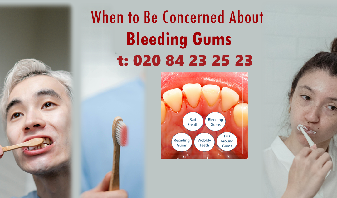 Gum Disease Treatment in Harrow, London