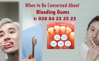Effective Dental Treatments to Stop Bleeding Gums in Harrow, London