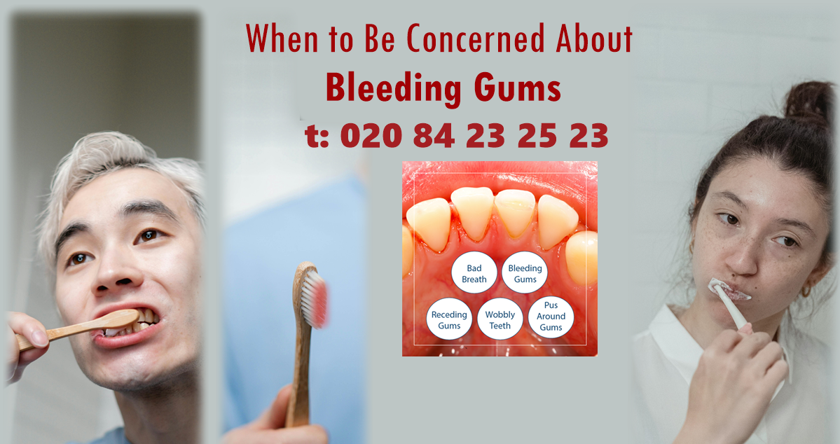 Effective Dental Treatments to Stop Bleeding Gums in Harrow, London