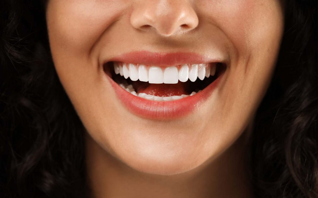 Choosing the Right Dental Mouthguard