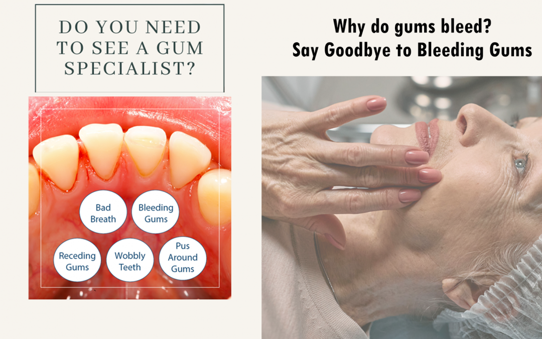 Why do gums bleed? Say Goodbye to Bleeding Gums