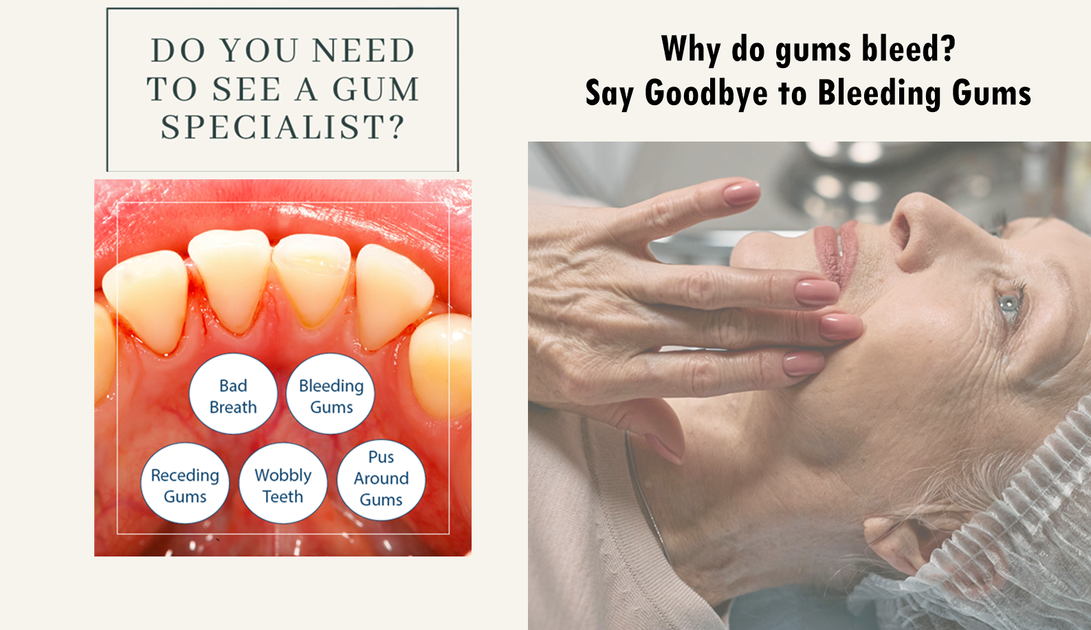 Why do gums bleed